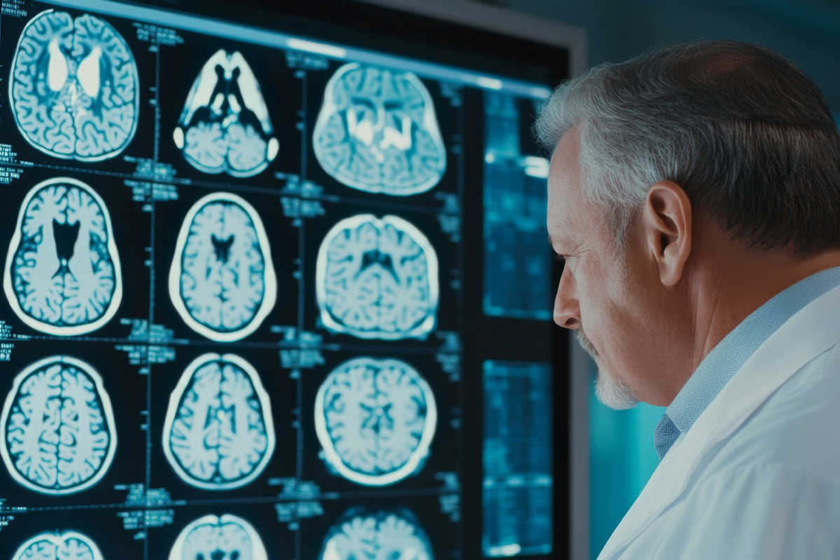 Deep Dive into the Different Types of Dementia